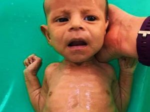 The God's Child Project - image of Malnourished Child in Bath
